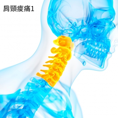 肩頸痠痛
