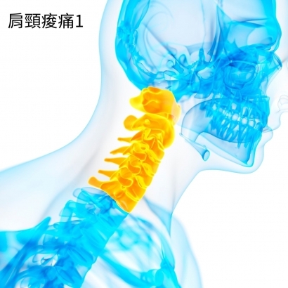 肩頸痠痛